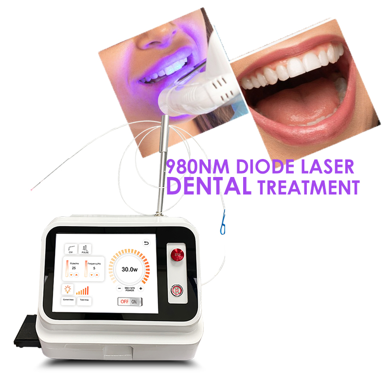 2024 Hot Sale Dental Soft Tiss - Teeth Whitening With Laser recension och pris