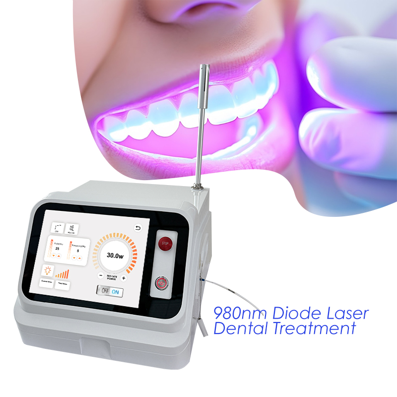 2024 Hot Sale Dental Soft Tiss - Teeth Whitening With Laser recension och pris